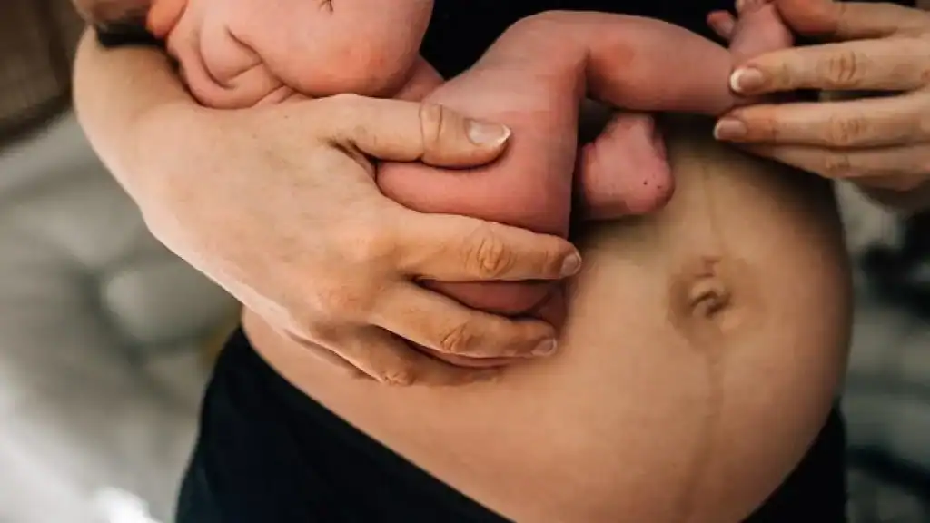 Why Is My Stomach Still Big After Pregnancy Haverhill?